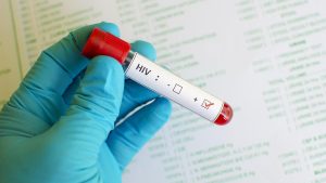 Kemenkes RI Klarifikasi Lonjakan Kasus HIV di Sidoarjo Bukan Akibat Peningkatan Penularan