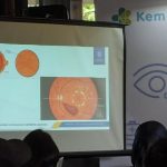 Waspada! Penglihatan Kabur Bukan Hanya Katarak, Kenali Retinopati Diabetik