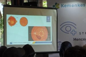 Waspada! Penglihatan Kabur Bukan Hanya Katarak, Kenali Retinopati Diabetik