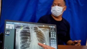 82 Juta Warga Telah Manfaatkan Cek Kesehatan Gratis, Ini Penyakit yang Paling Sering Terdeteksi