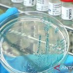 Kasus Flu Burung Meningkat, Australia Terapkan Karantina Wajib