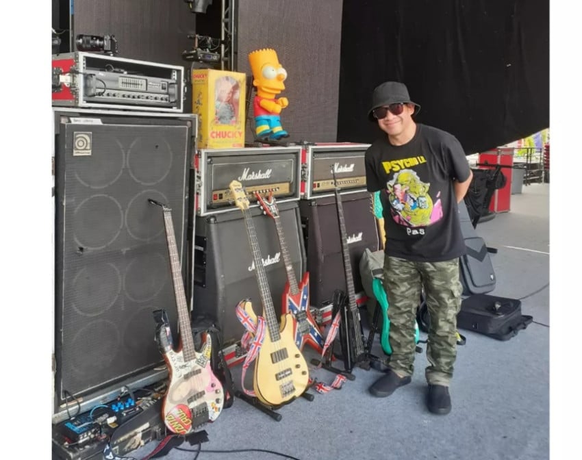 Kepergian Trisno, Bassist Pas Band, Setelah Melawan Komplikasi