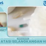 Kulit Selangkangan Hitam? Dokter Jelaskan Hubungannya dengan Obesitas dan Diabetes