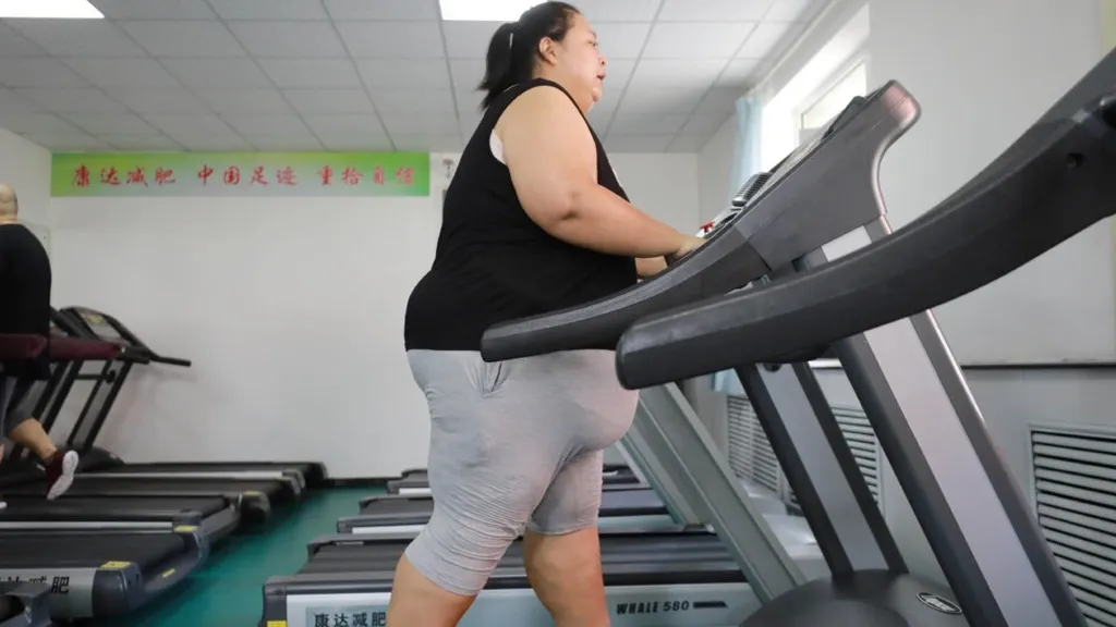 Obesitas sebagai Penyakit: Penanganan Lebih dari Sekadar Diet dan Olahraga