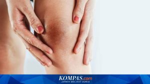 Pahami Penyebab Asam Urat dan Langkah Pencegahannya Menurut Dokter RS UNS