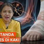 Panduan Perawatan Luka bagi Penderita Diabetes