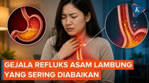 Tanda-Tanda Refluks Asam Lambung yang Jarang Disadari