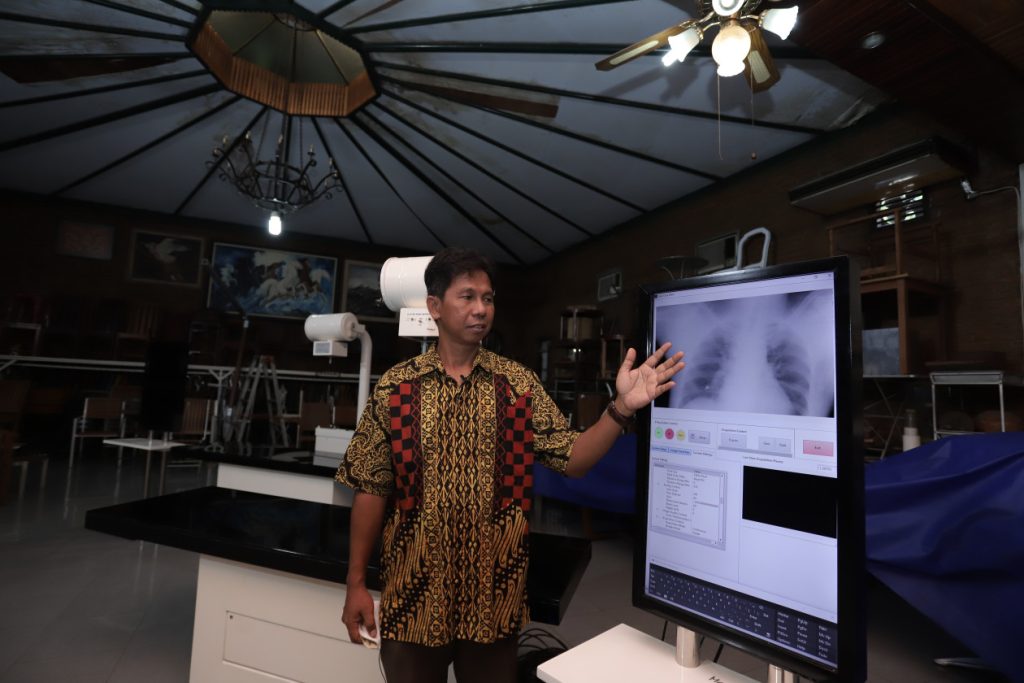UGM Luncurkan Rumah Skrining dan Radiografi Keliling untuk Percepat Eliminasi Tuberkulosis